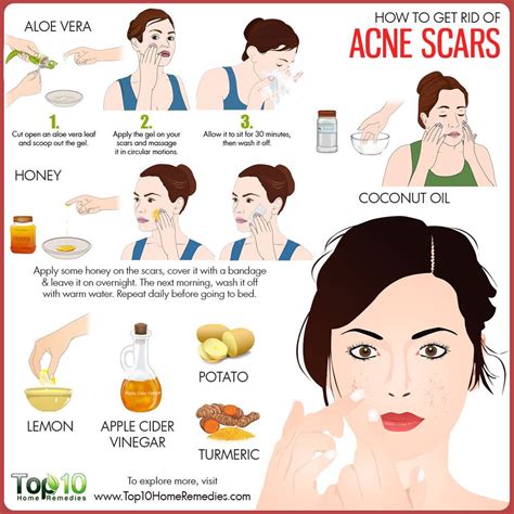 boni scars|How to get rid of acne scars: your ultimate guide